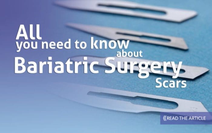Bariatric Surgery Scars